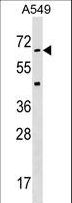 STK35 Antibody - STK35 Antibody (C255) western blot of A549 cell line lysates (35 ug/lane). The STK35 antibody detected the STK35 protein (arrow).