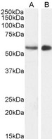 STK35 Antibody - Clik1 / STK35 antibody (1µg/ml) staining of Mouse (A) and (2ug/ml) Pig (B) Testes lysate (35µg protein in RIPA buffer). Detected by chemiluminescence.