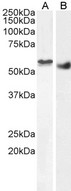 STK35 Antibody - Clik1 / STK35 antibody (2µg/ml) staining of nuclear HEK293 (A) and (1ug/ml) Human Breast cancer (B) lysate (35µg protein in RIPA buffer). Detected by chemiluminescence.