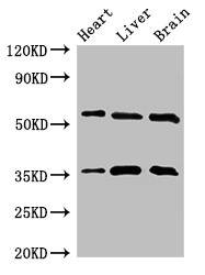 STK35 Antibody - Positive WB detected in:Mouse heart tissue,Mouse liver tissue,Mouse brain tissue;All lanes:STK35 antibody at 2.5?g/ml;Secondary;Goat polyclonal to rabbit IgG at 1/50000 dilution;Predicted band size: 59 KDa;Observed band size: 59,36 KDa;