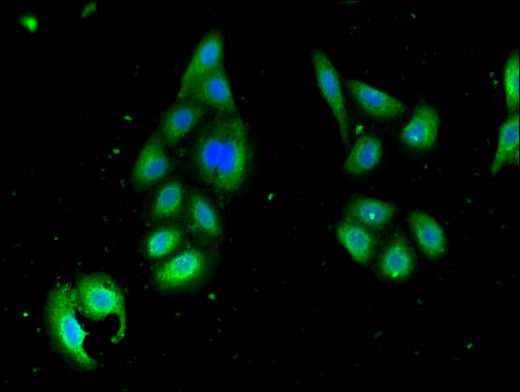 STK35 Antibody - Immunofluorescent analysis of HepG2 cells using STK35 Antibody at a dilution of 1:100 and Alexa Fluor 488-congugated AffiniPure Goat Anti-Rabbit IgG(H+L)