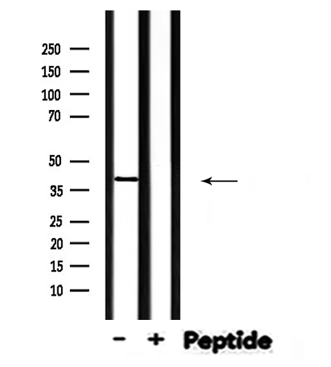 STK36 Antibody - Western blot analysis of STK36 expression in mouse muscle lysate 