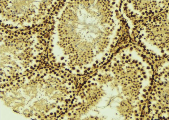 STK36 Antibody - 1:100 staining mouse testis tissue by IHC-P. The sample was formaldehyde fixed and a heat mediated antigen retrieval step in citrate buffer was performed. The sample was then blocked and incubated with the antibody for 1.5 hours at 22°C. An HRP conjugated goat anti-rabbit antibody was used as the secondary.