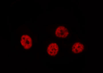 STK36 Antibody - Staining HeLa cells by IF/ICC. The samples were fixed with PFA and permeabilized in 0.1% Triton X-100, then blocked in 10% serum for 45 min at 25°C. The primary antibody was diluted at 1:200 and incubated with the sample for 1 hour at 37°C. An Alexa Fluor 594 conjugated goat anti-rabbit IgG (H+L) antibody, diluted at 1/600, was used as secondary antibody.