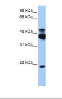 STK38 Antibody - HepG2 cell lysate. Antibody concentration: 1.0 ug/ml. Gel concentration: 12%.  This image was taken for the unconjugated form of this product. Other forms have not been tested.