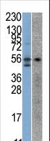 STK38 Antibody - The anti-STK38 antibody is used in Western blot to detect STK38 in SK-Br-3 (left) and Jurkat (right) cell line lysates.