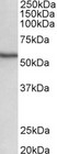 STK38 Antibody - STK38 antibody (0.5 ug/ml) staining of Human Spleen lysate (35 ug protein in RIPA buffer). Primary incubation was 1 hour. Detected by chemiluminescence.