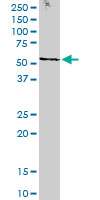 STK38 Antibody - STK38 monoclonal antibody (M11), clone 2F6. Western blot of STK38 expression in human kidney.