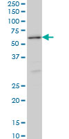STK38 Antibody - STK38 monoclonal antibody (M11), clone 2F6 Western blot of STK38 expression in HeLa NE.