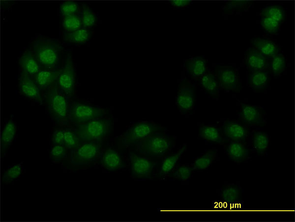 STK38 Antibody - Immunofluorescence of monoclonal antibody to STK38 on HeLa cell. [antibody concentration 10 ug/ml]