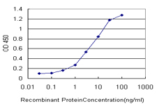 STK38 Antibody - Detection limit for recombinant GST tagged STK38 is approximately 0.3 ng/ml as a capture antibody.