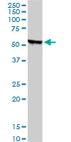 STK38 Antibody - STK38 monoclonal antibody (M01), clone 2G8-1F3. Western blot of STK38 expression in human kidney.
