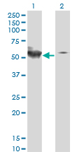 STK38 Antibody - Western blot of STK38 expression in transfected 293T cell line by STK38 monoclonal antibody (M01), clone 2G8-1F3.