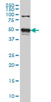 STK38 Antibody - STK38 monoclonal antibody (M02), clone 3A5 Western blot of STK38 expression in HeLa NE.