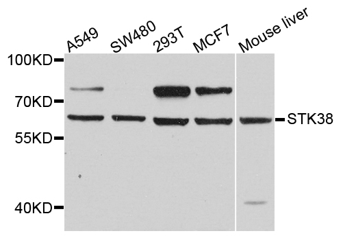 STK38 Antibody - Western blot analysis of extract of various cells.