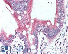 STK38 Antibody - Human Small Intestine: Formalin-Fixed, Paraffin-Embedded (FFPE)