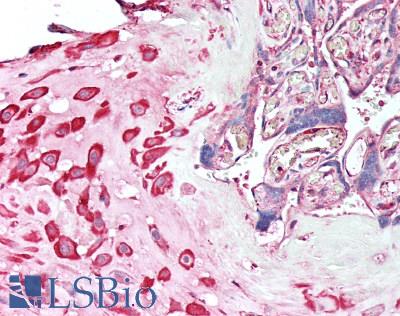 STK38 Antibody - Human Placenta: Formalin-Fixed, Paraffin-Embedded (FFPE)