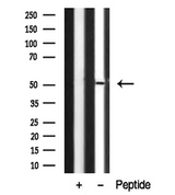 STK38 Antibody - Western blot analysis of NDR1/2 in lysates of HepG2 cells using NDR1/2 antibody.
