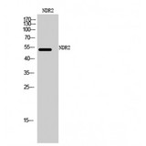 STK38L / NDR2 Antibody - Western blot of NDR2 antibody