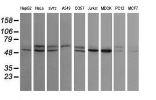 STK38L / NDR2 Antibody - Western blot of extracts (35 ug) from 9 different cell lines by using g anti-STK38L monoclonal antibody (HepG2: human; HeLa: human; SVT2: mouse; A549: human; COS7: monkey; Jurkat: human; MDCK: canine; PC12: rat; MCF7: human).