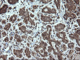 STK38L / NDR2 Antibody - IHC of paraffin-embedded Human breast tissue using anti-STK38L mouse monoclonal antibody.