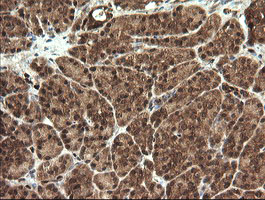 STK38L / NDR2 Antibody - IHC of paraffin-embedded Human pancreas tissue using anti-STK38L mouse monoclonal antibody.