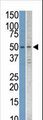 STK38L / NDR2 Antibody - The anti-STK38L antibody is used in Western blot to detect STK38L in Jurkat and T47D cell line lysates.