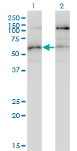 STK38L / NDR2 Antibody - Western blot of STK38L expression in transfected 293T cell line by STK38L monoclonal antibody (M01), clone 4E5.