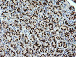 STK38L / NDR2 Antibody - IHC of paraffin-embedded Human pancreas tissue using anti-STK38L mouse monoclonal antibody.
