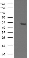 STK38L / NDR2 Antibody - HEK293T cells were transfected with the pCMV6-ENTRY control (Left lane) or pCMV6-ENTRY STK38L (Right lane) cDNA for 48 hrs and lysed. Equivalent amounts of cell lysates (5 ug per lane) were separated by SDS-PAGE and immunoblotted with anti-STK38L.