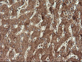 STK38L / NDR2 Antibody - IHC of paraffin-embedded Human liver tissue using anti-STK38L mouse monoclonal antibody.