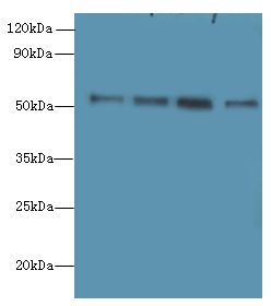 STK38L / NDR2 Antibody - Western blot. All lanes: STK38L antibody at 6 ug/ml. Lane 1: A375 whole cell lysate. Lane 2: HepG-2 whole cell lysate. Lane 3: A549 whole cell lysate. Lane 4: HCT116 whole cell lysate. Secondary Goat polyclonal to Rabbit IgG at 1:10000 dilution. Predicted band size: 54 kDa. Observed band size: 54 kDa.