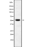 STK38L / NDR2 Antibody - Western blot analysis STK38L using K562 whole cells lysates