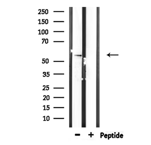 STK38L / NDR2 Antibody - Western blot analysis of extracts of HepG2 cells using STK38L antibody.