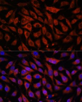 STK38L / NDR2 Antibody - Immunofluorescence analysis of L929 cells using STK38L Polyclonal Antibody at dilution of 1:100.Blue: DAPI for nuclear staining.