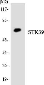 STK39 / SPAK Antibody - Western blot analysis of the lysates from HepG2 cells using STK39 antibody.