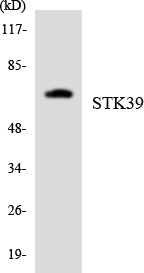 STK39 / SPAK Antibody - Western blot analysis of the lysates from HeLa cells using STK39 antibody.