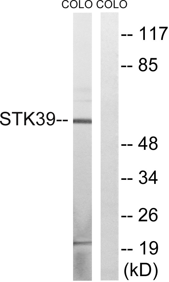STK39 / SPAK Antibody - Western blot analysis of lysates from COLO cells, using STK39 Antibody. The lane on the right is blocked with the synthesized peptide.