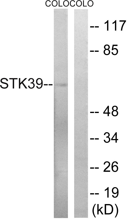 STK39 / SPAK Antibody - Western blot analysis of lysates from COLO cells, using STK39 Antibody. The lane on the right is blocked with the synthesized peptide.