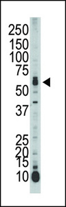 STK39 / SPAK Antibody - Western blot of anti-SPAK antibody in mouse liver tissue lysate. SPAK (arrow) was detected using purified antibody. Secondary HRP-anti-rabbit was used for signal visualization with chemiluminescence.
