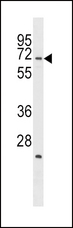 STK39 / SPAK Antibody - SPAK Antibody (A363) western blot of U937 cell line lysates (35 ug/lane). The SPAK antibody detected the SPAK protein (arrow).