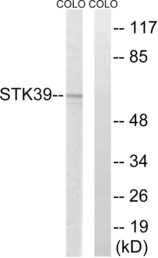 STK39 / SPAK Antibody - Western blot analysis of lysates from COLO205 cells, using STK39 Antibody. The lane on the right is blocked with the synthesized peptide.