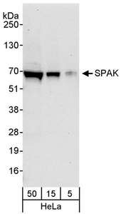 STK39 / SPAK Antibody - Detection of Human SPAK by Western Blot. Samples: Whole cell lysate (5, 15 and 50 ug) from HeLa cells. Antibodies: Affinity purified rabbit anti-SPAK antibody used for WB at 0.04 ug/ml. Detection: Chemiluminescence with an exposure time of 30 seconds.