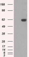 STK39 / SPAK Antibody - HEK293T cells were transfected with the pCMV6-ENTRY control (Left lane) or pCMV6-ENTRY STK39 (Right lane) cDNA for 48 hrs and lysed. Equivalent amounts of cell lysates (5 ug per lane) were separated by SDS-PAGE and immunoblotted with anti-STK39.