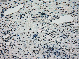 STK39 / SPAK Antibody - IHC of paraffin-embedded Ovary tissue using anti-STK39 mouse monoclonal antibody. (Dilution 1:50).