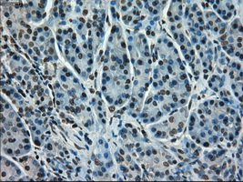 STK39 / SPAK Antibody - IHC of paraffin-embedded pancreas tissue using anti-STK39 mouse monoclonal antibody. (Dilution 1:50).