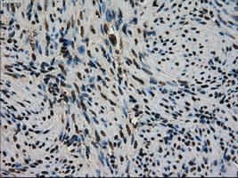 STK39 / SPAK Antibody - IHC of paraffin-embedded endometrium tissue using anti-STK39 mouse monoclonal antibody. (Dilution 1:50).