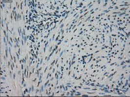 STK39 / SPAK Antibody - IHC of paraffin-embedded endometrium tissue using anti-STK39 mouse monoclonal antibody. (Dilution 1:50).