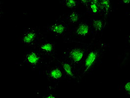 STK39 / SPAK Antibody - Immunofluorescent staining of COS7 cells using anti-STK39 mouse monoclonal antibody.