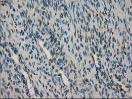 STK39 / SPAK Antibody - Immunohistochemical staining of paraffin-embedded Ovary tissue using anti-STK39 mouse monoclonal antibody. (Dilution 1:50).